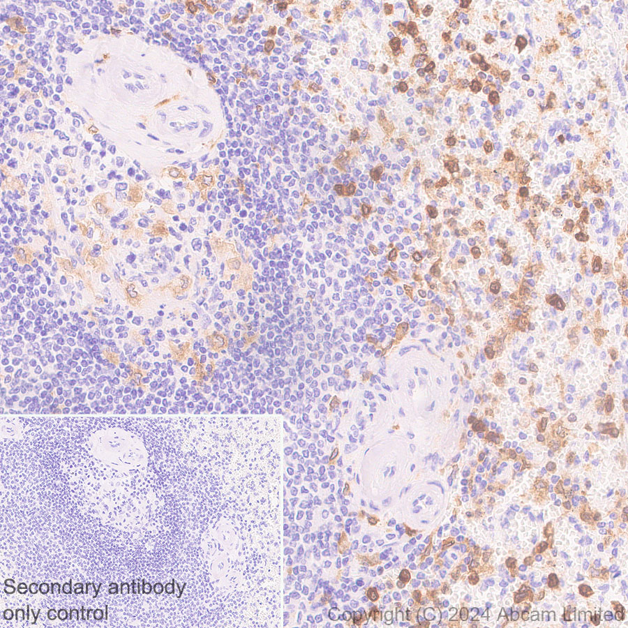 Immunohistochemistry (Formalin/PFA-fixed paraffin-embedded sections) - Anti-DAP12 antibody [EPR29151-41] (ab323318), expandable thumbnail