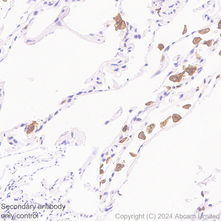Immunohistochemistry (Formalin/PFA-fixed paraffin-embedded sections) - Anti-DAP12 antibody [EPR29151-41] (ab323318), expandable thumbnail