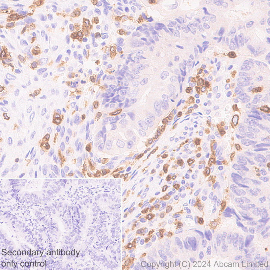 Immunohistochemistry (Formalin/PFA-fixed paraffin-embedded sections) - Anti-DAP12 antibody [EPR29151-41] (AB323318), expandable thumbnail
