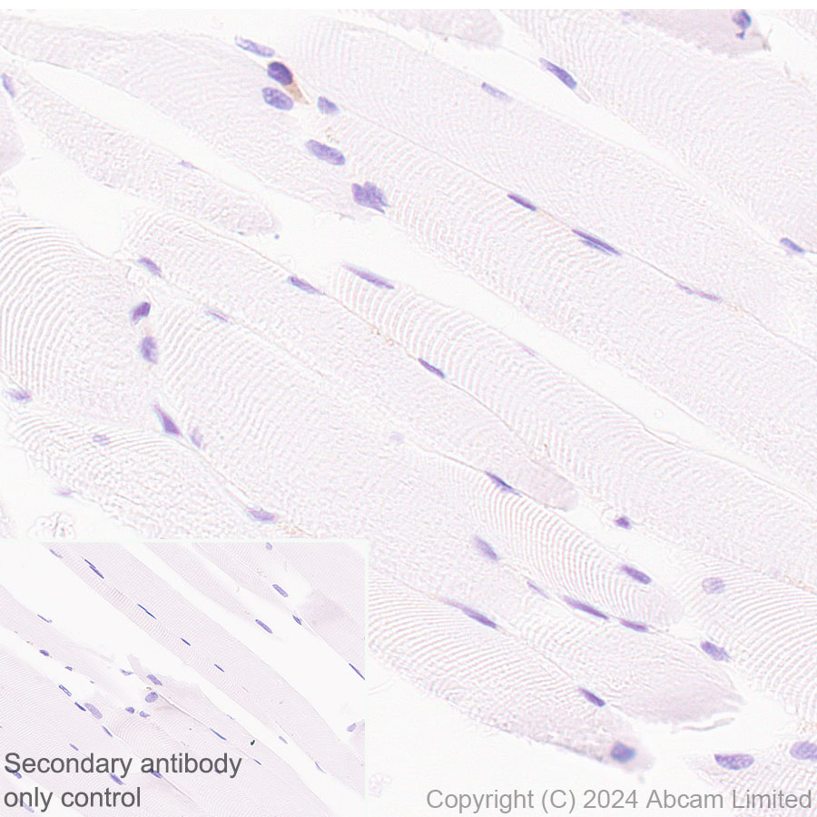 Immunohistochemistry (Formalin/PFA-fixed paraffin-embedded sections) - Anti-DAP12 antibody [EPR29151-41] (AB323318), expandable thumbnail