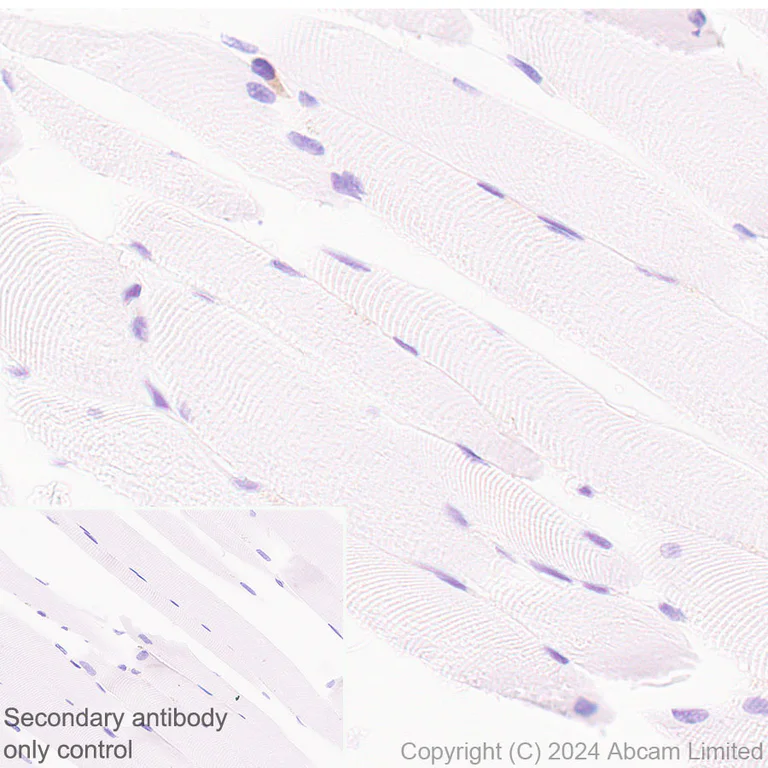 Immunohistochemistry (Formalin/PFA-fixed paraffin-embedded sections) - Anti-DAP12 antibody [EPR29151-41] - BSA and Azide free (AB326592)