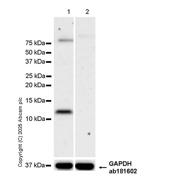 Western blot - Anti-DAP12 antibody [EPR29151-41] - BSA and Azide free (AB326592)