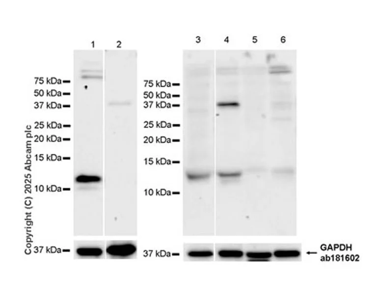 Western blot - Anti-DAP12 antibody [EPR29151-41] - BSA and Azide free (AB326592)