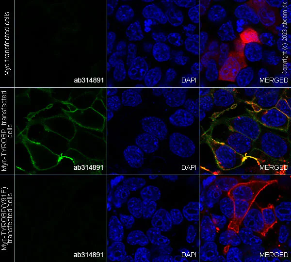 Immunocytochemistry/ Immunofluorescence - Anti-DAP12 (phospho Y91) antibody [EPR25630-43] (AB314891)