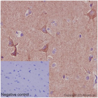 Immunohistochemistry (Formalin/PFA-fixed paraffin-embedded sections) - Anti-DAP13/NDUFA12 antibody [EPR15867-28] (ab192617), expandable thumbnail