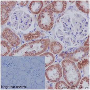 Immunohistochemistry (Formalin/PFA-fixed paraffin-embedded sections) - Anti-DAP13/NDUFA12 antibody [EPR15867-28] (ab192617), expandable thumbnail