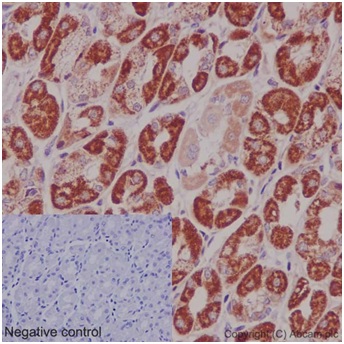 Immunohistochemistry (Formalin/PFA-fixed paraffin-embedded sections) - Anti-DAP13/NDUFA12 antibody [EPR15867-28] (ab192617), expandable thumbnail