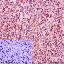 Immunohistochemistry (Formalin/PFA-fixed paraffin-embedded sections) - Anti-DAP13/NDUFA12 antibody [EPR15867] (ab192607), expandable thumbnail