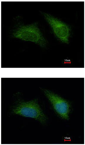 Immunocytochemistry/ Immunofluorescence - Anti-DAP3 antibody (AB155499)