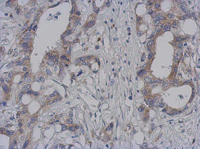 Immunohistochemistry (Formalin/PFA-fixed paraffin-embedded sections) - Anti-DAP3 antibody (AB155499)