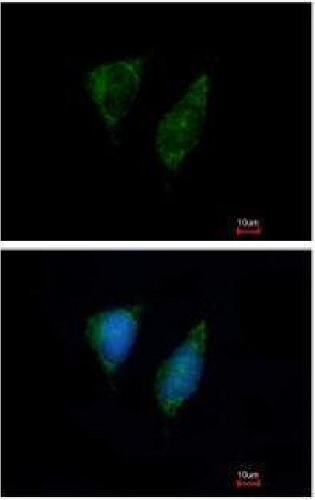Immunocytochemistry/ Immunofluorescence - Anti-DAP3 antibody (AB227257)