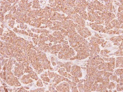 Immunohistochemistry (Formalin/PFA-fixed paraffin-embedded sections) - Anti-DAP3 antibody (AB227257)