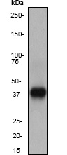 Anti-DAPK2 antibody [EP1633Y]