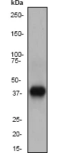 Western blot - Anti-DAPK2 antibody [EP1633Y] (AB51601)