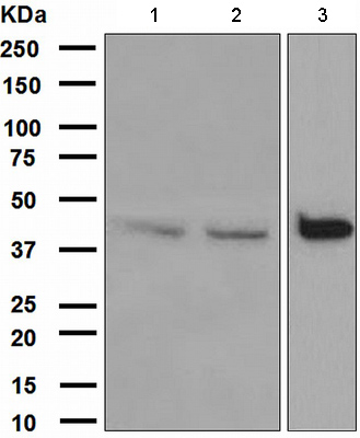 Western blot - Anti-DAPK2 antibody [EPR1634(2)] (AB111928), expandable thumbnail