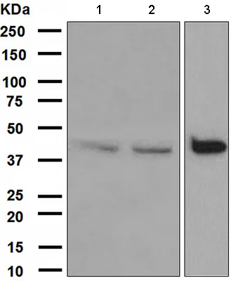 Western blot - Anti-DAPK2 antibody [EPR1634(2)] (AB111928)
