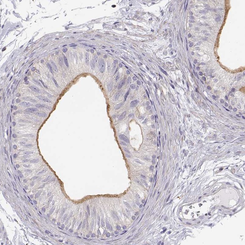 Immunohistochemistry (Formalin/PFA-fixed paraffin-embedded sections) - Anti-DAPL1 antibody (AB150969), expandable thumbnail