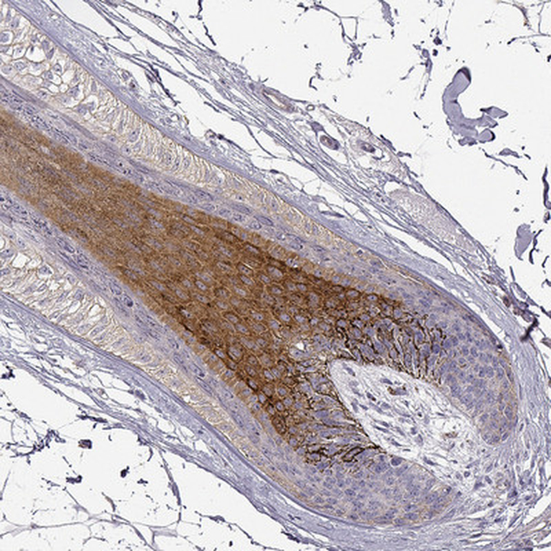 Immunohistochemistry (Formalin/PFA-fixed paraffin-embedded sections) - Anti-DAPL1 antibody (AB150969), expandable thumbnail