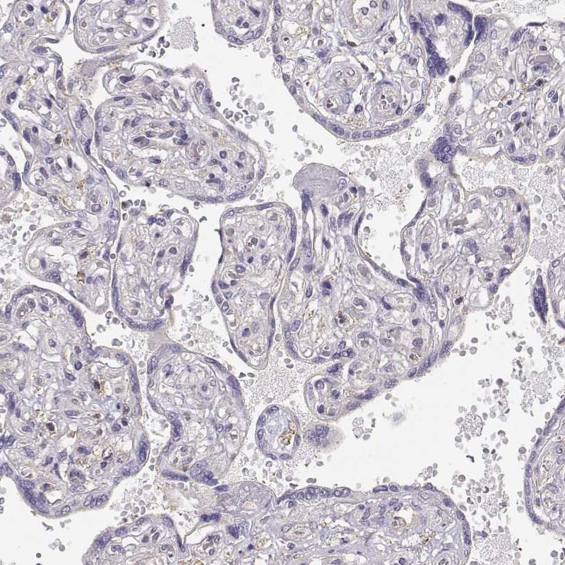 Immunohistochemistry (Formalin/PFA-fixed paraffin-embedded sections) - Anti-DAPL1 antibody (AB150969), expandable thumbnail