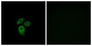 Immunocytochemistry/ Immunofluorescence - Anti-DARC antibody (AB124648)