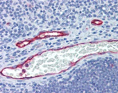 Immunohistochemistry (Formalin/PFA-fixed paraffin-embedded sections) - Anti-DARC antibody (AB124648)