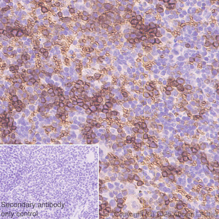 Immunohistochemistry (Formalin/PFA-fixed paraffin-embedded sections) - Anti-DARC antibody [EPR29719-512] - BSA and Azide free (AB325143)