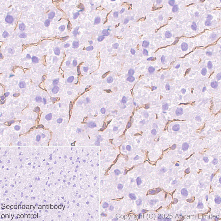 Immunohistochemistry (Formalin/PFA-fixed paraffin-embedded sections) - Anti-DARC antibody [EPR29719-512] - BSA and Azide free (AB325143)