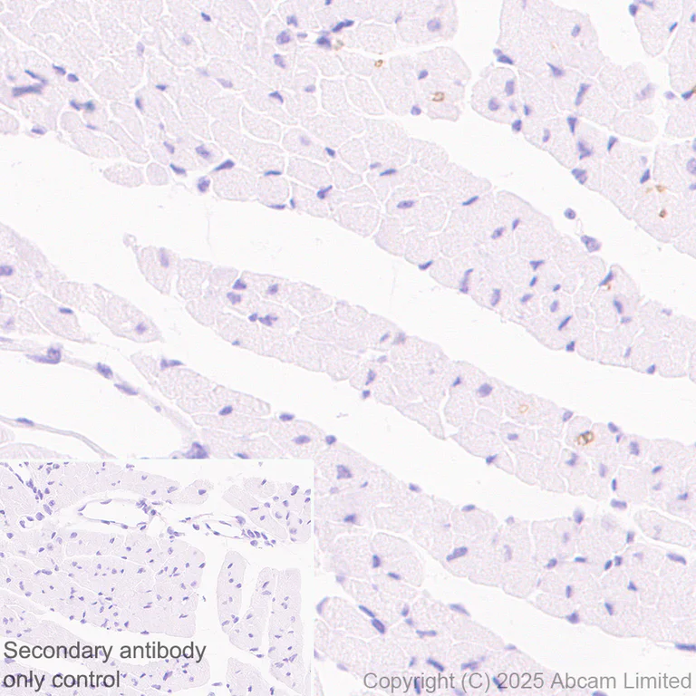 Immunohistochemistry (Formalin/PFA-fixed paraffin-embedded sections) - Anti-DARC antibody [EPR29719-512] - BSA and Azide free (AB325143)