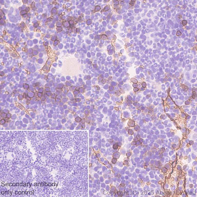 Immunohistochemistry (Formalin/PFA-fixed paraffin-embedded sections) - Anti-DARC antibody [EPR29719-512] - BSA and Azide free (AB325143)