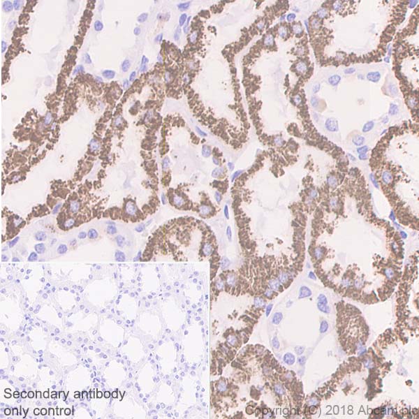 Immunohistochemistry (Formalin/PFA-fixed paraffin-embedded sections) - Anti-DARC antibody [EPR5205] (AB137044)