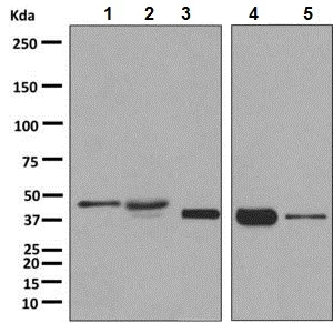 Western blot - Anti-DARC antibody [EPR5205] (AB137044)