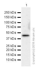 Western blot - Anti-DARC antibody [EPR5205] (AB137044)