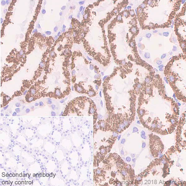 Immunohistochemistry (Formalin/PFA-fixed paraffin-embedded sections) - Anti-DARC antibody [EPR5205] - BSA and Azide free (AB240100)