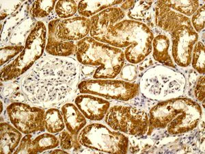 Immunohistochemistry (Formalin/PFA-fixed paraffin-embedded sections) - Anti-DARC antibody [EPR5205] - BSA and Azide free (AB240100)