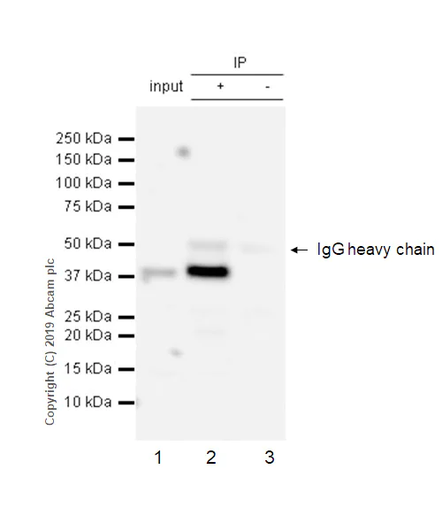 Immunoprecipitation - Anti-DARC antibody [EPR5205] - BSA and Azide free (AB240100)