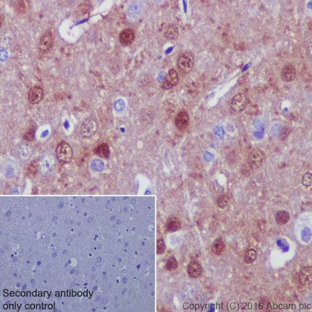 Immunohistochemistry (Formalin/PFA-fixed paraffin-embedded sections) - Anti-DARPP32 antibody [EP720Y] (AB40801)