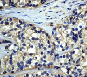 Immunohistochemistry (Formalin/PFA-fixed paraffin-embedded sections) - Anti-DARPP32 antibody [EP720Y] (AB40801)
