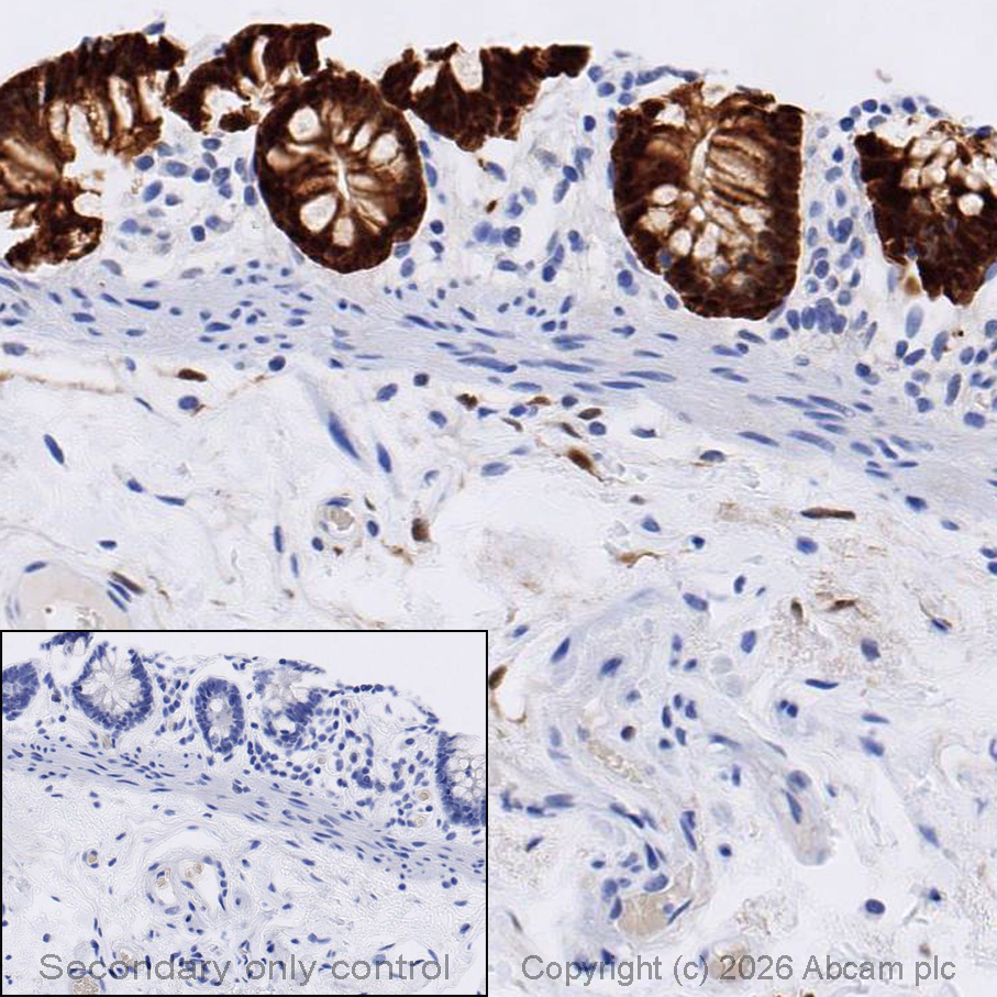 Immunohistochemistry (Formalin/PFA-fixed paraffin-embedded sections) - Anti-DARPP32 antibody [EP720Y] (AB40801)