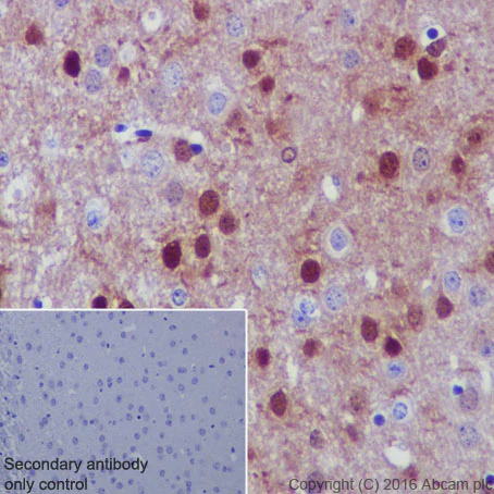 Immunohistochemistry (Formalin/PFA-fixed paraffin-embedded sections) - Anti-DARPP32 antibody [EP720Y] (AB40801)