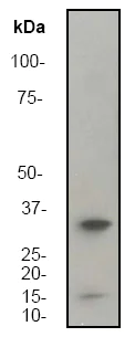 Western blot - Anti-DARPP32 antibody [EP720Y] (AB40801)