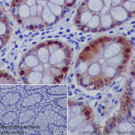 Immunohistochemistry (Formalin/PFA-fixed paraffin-embedded sections) - Anti-DARPP32 antibody [EP720Y] - BSA and Azide free (AB220808)