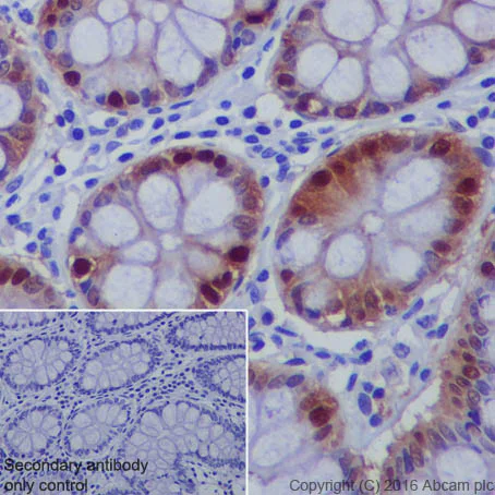 Immunohistochemistry (Formalin/PFA-fixed paraffin-embedded sections) - Anti-DARPP32 antibody [EP720Y] - BSA and Azide free (AB220808)