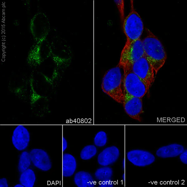 Immunocytochemistry/ Immunofluorescence - Anti-DARPP32 antibody [EP721Y] - BSA and Azide free (AB239831)