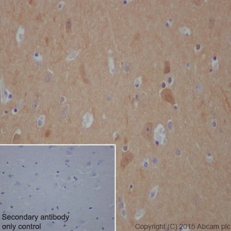 Immunohistochemistry (Formalin/PFA-fixed paraffin-embedded sections) - Anti-DARPP32 antibody [EP721Y] - BSA and Azide free (AB239831)