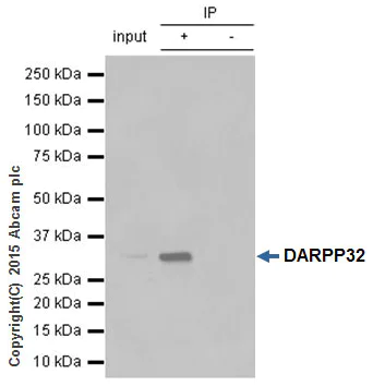 Immunoprecipitation - Anti-DARPP32 antibody [EP721Y] - BSA and Azide free (AB239831)