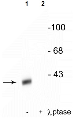 Western blot - Anti-DARPP32 (phospho T34) antibody (AB254063)