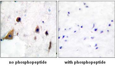 Immunohistochemistry (Formalin/PFA-fixed paraffin-embedded sections) - Anti-DARPP32 (phospho T75) antibody (AB51114)