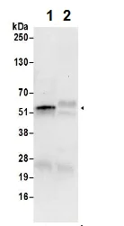 Immunoprecipitation - Anti-DARS antibody (AB206695)
