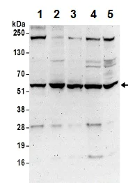 Western blot - Anti-DARS antibody (AB206695)