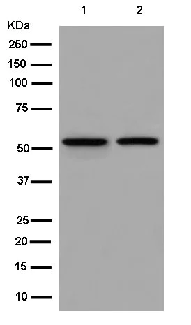 Western blot - Anti-DARS antibody [EPR14846(B)] - BSA and Azide free (AB250552)